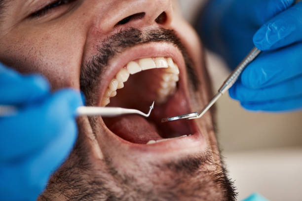 Best Emergency Tooth Extraction in Inkerman, PA