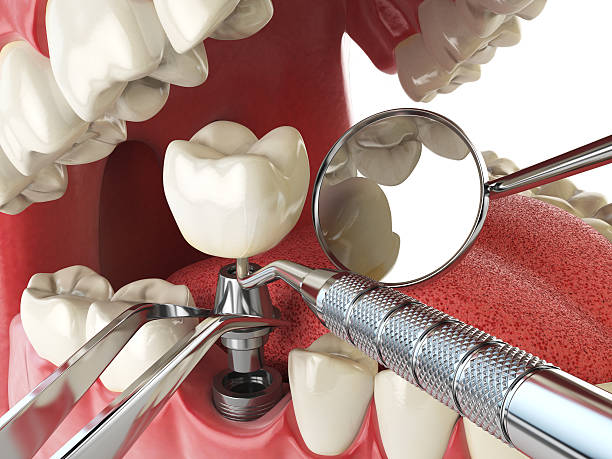 Best Emergency Orthodontic Repairs in Inkerman, PA